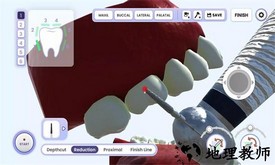 牙医模拟器游戏 v1.0.6 安卓版 0
