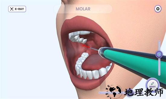 牙医模拟器游戏 v1.0.6 安卓版 2