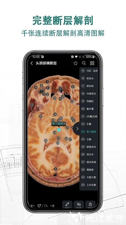 掌上3d解剖app v2.7.1 安卓版 0