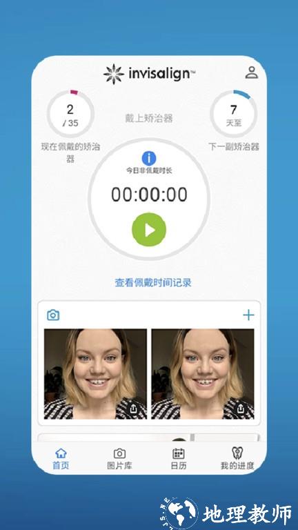 my invisalign 最新版本 v5.4.1 安卓版 3